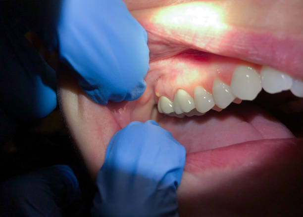 Best Emergency Dentist for Special Needs Patients in Gibsonville, NC