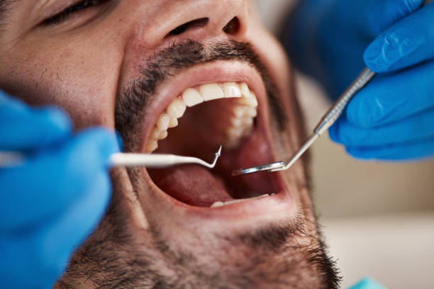 Best Urgent Dental Care for Toothache in Gibsonville, NC