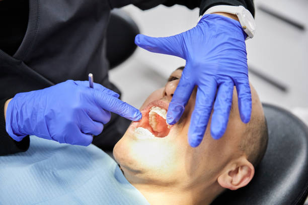 Best Emergency Dentist for Lost Fillings or Crowns in Gibsonville, NC
