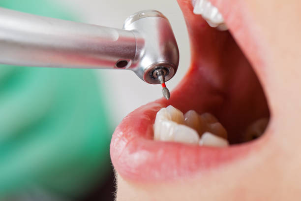 Best Emergency Dental Care for Abscessed Tooth in Gibsonville, NC